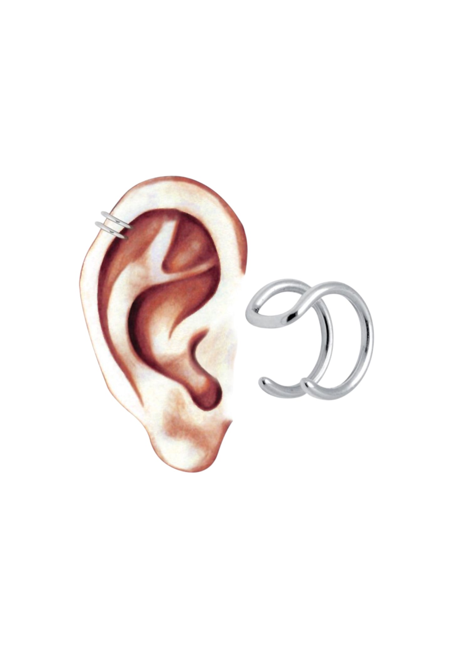 Faux anneau de cartilage